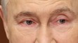Vladimir Putin měl zarudlé oči