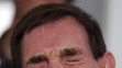 Tony Nicklinson