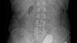 Rentgeny - 1