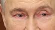Vladimir Putin měl zarudlé oči