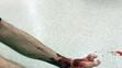 Masožraví červi v moři okousali plavci nohy