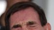 Tony Nicklinson