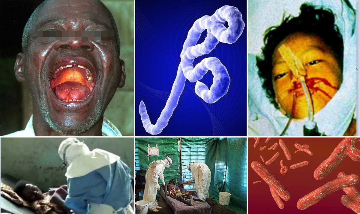 Jak vypadá Ebola?