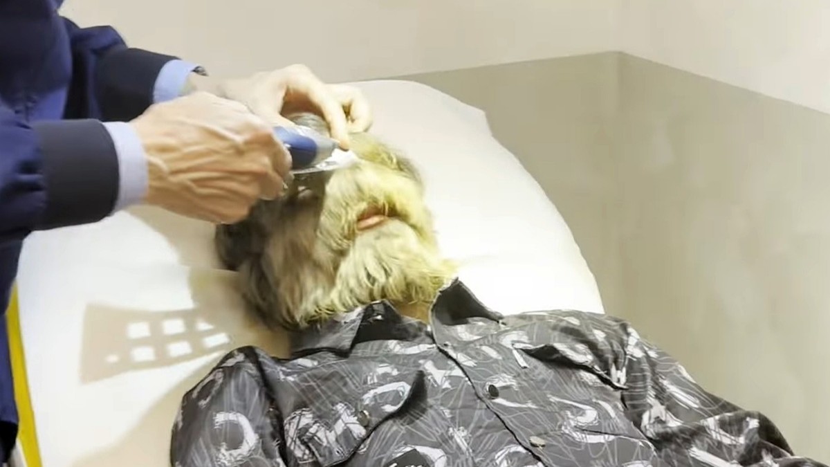 Mladík se dostal do knihy rekordů. Má nejchlupatější obličej na světě