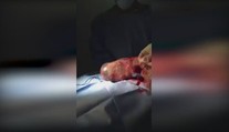 Nádherné zrození: Dítě se narodilo ještě v plodovém vaku! VIDEO