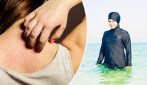 Hygienička varuje: Burkini mohou skrývat nakažlivé choroby!