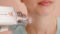 Nádorů kůže přibývá. Pět symptomů, se kterými byste měli hned vyrazit k lékaři