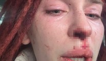 Misska byla obětí brutálního násilí. Přiznal se k tomu známý zpěvák