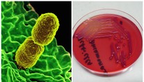 V polské nemocnici našli vzácnou bakterii. Je odolná vůči antibiotikům
