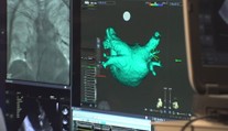 Pokrok v léčbě srdeční arytmie. Nová metoda českých lékařů je rychlejší a šetrnější