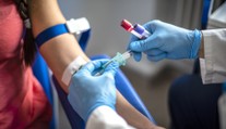 Neviditelná nemoc přispívá k milionům úmrtí ročně. Změňte pár návyků, říká lékař