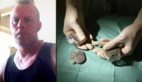 Muž ošálil lékaře, na cizí identitu mu voperovali kardiostimulátor!