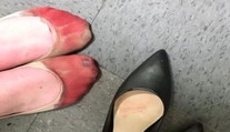Krvavé nohy po celodenní práci! Komu patří zničená chodidla?