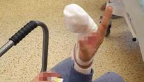 Malý chlapec si na koloběžce zranil ruku, utržený prst našli v parku