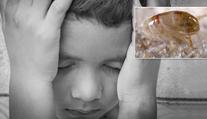 Blecha nakazila chlapce morem! Lékaři teď bojují o jeho život
