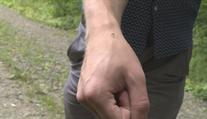 Proč komáři útočí právě na vás? Důvodů může být několik