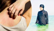 Hygienička varuje: Burkini mohou skrývat nakažlivé choroby!
