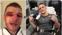 Poirier s Hookerem stanovili nový UFC rekord! Takhle dopadli po zápase