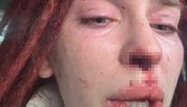 Misska byla obětí brutálního násilí. Přiznal se k tomu známý zpěvák