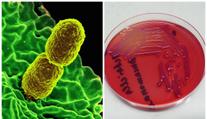 V polské nemocnici našli vzácnou bakterii. Je odolná vůči antibiotikům