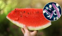 Hygienici varují: Melouny mohou způsobit i úplavici, na tohle pozor!