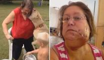 Nejdrsnější kyblíková výzva: Ženu kousnul do tváře pitbull! VIDEO