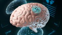 Revoluční implantát: Pomáhá ochrnutým pacientům k návratu do života