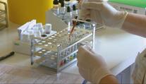 V Česku roste počet nakažených žloutenkou. Hygienici zavádějí opatření
