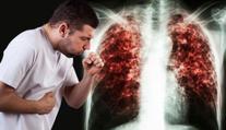 Tuberkulóza v ČR po krajích: Kolik nakažených hlásí u vás? PŘEHLED