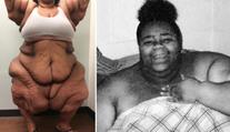 Musíte vidět: Nejtěžší žena světa shodila 200 kilogramů! GALERIE