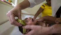 Potvrzeno: Virus zika způsobuje mikrocefalii! Na vakcíně se pracuje