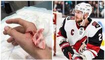 Stehy a tetanus! Hvězdného obránce NHL pokousal jeho vlastní pes