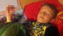 Gumičková závislost: Školák (8) málem přišel o prsty! Foto uvnitř
