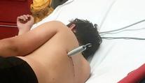 Hra na trampolíně se změnila v horor! Chlapec skončil s pružinou v zádech
