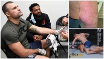 To musí bolet! UFC veterán po prohře odhalil ošklivé zranění