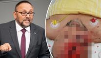 Poslance AfD v Brémách brutálně napadli. Je vážně zraněný