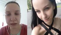Hororový zubař v Teplicích! Žena má po zákroku zničené zuby i dásně