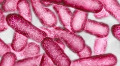 V teplé vodě z českobudějovické teplárny může být nebezpečná legionella