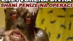 Znetvořená dívka shání peníze na operaci