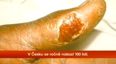 Na severu Čech hrozí nebezpečná nemoc zajíců