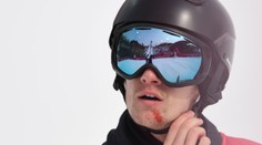 Hvězdě snowboardingu se otočil život. Medaili z OH střídá rakovina!