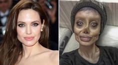 Měla vypadat jako Angelina Jolie. Takhle po 50 operacích dopadla!