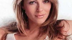 Modelka Liz Hurleyová má plešku