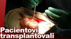 Pacientovi transplantovali ŠPATNOU LEDVINU