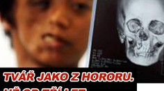Tvář jako z hororu. Už od tří let