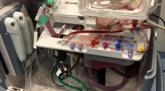 Fascinující podívaná: Srdce tlouklo celou cestu od dárce k pacientovi