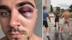 Surový útok na videu! Adama zbili čtyři muži, čeká ho už třetí operace