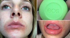 Použila oblíbený balzám na rty a takhle dopadla! EOS čelí žalobě
