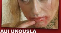 AU! Ukousla partnerovi VARLATA!