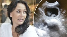 Heidi čeká přírůstek do rodiny! Pochlubila se fotkou z ultrazvuku